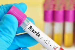 Vaksin Brucella