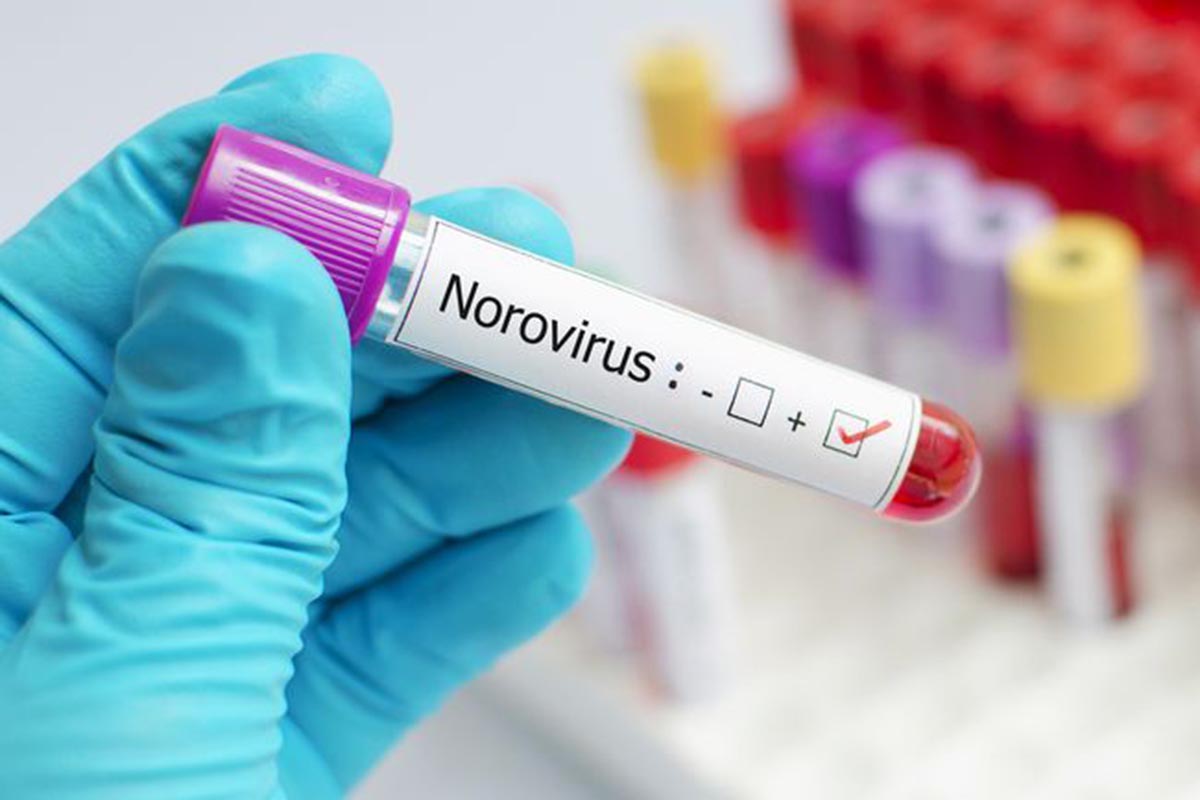 Ilustrasi Norovirus - Waspadai Norovirus yang Sudah Masuk ke Indonesia