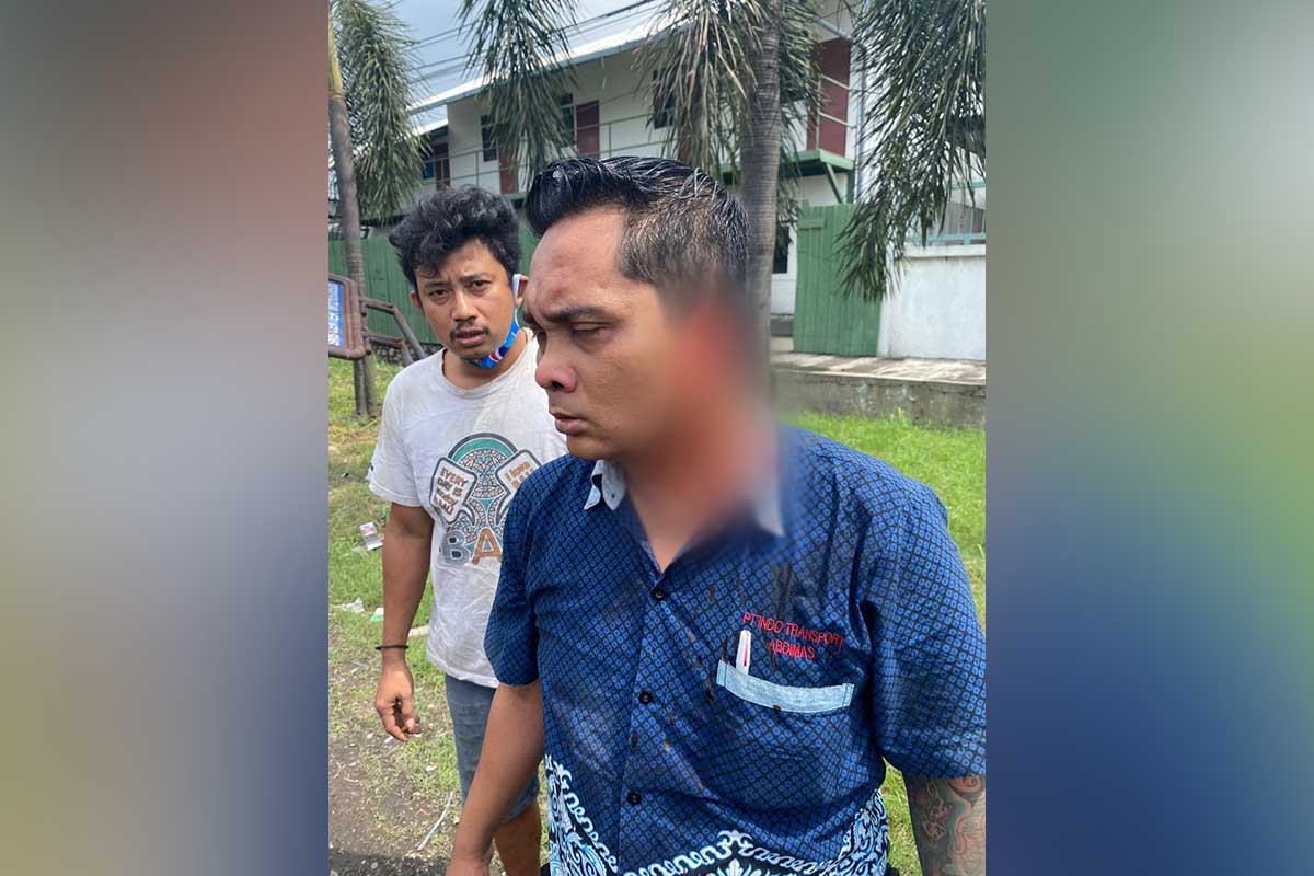 KORBAN - Seorang kondektur bus, Mandala Arfan Affandi (36) warga Tegalmulyo, Desa Mojosongo, Kecamatan Jetis, Mojokerto korban penganiayan pemukulan helm di JL Raya Bypas Krian mengalami luka di bagian telinga - Penganiaya Kondektur Bus Hingga Telinga Putus Diringkus Polisi