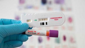 Ilustrasi rapid antigen. (ist) - Kemenkes Izinkan Rapid Antigen Untuk Lakukan Tracing