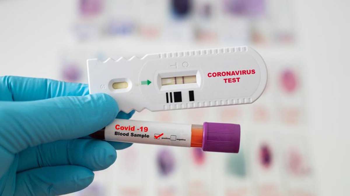 Ilustrasi rapid antigen. (ist) - Kemenkes Izinkan Rapid Antigen Untuk Lakukan Tracing