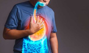 Ilustrasi penderita GERD. (ist) - Tips Puasa Bagi Penderita Asam Lambung Atau GERD