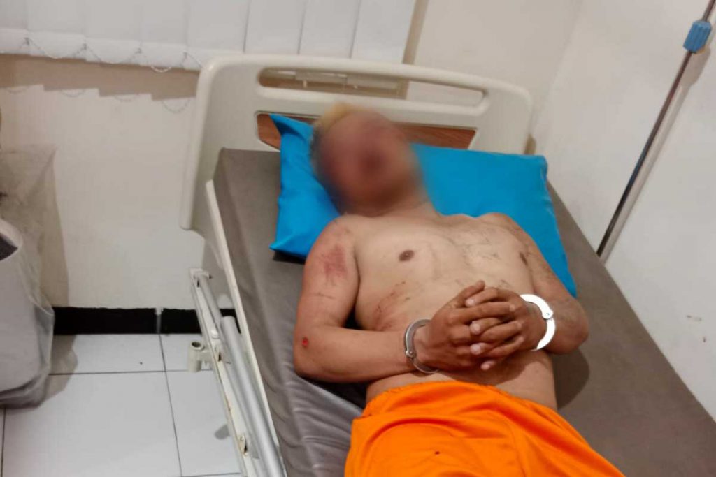 Tersangka dalam pengobatan di Puskesmas Jabung. (ist) - Maling Motor di Jabung Babak Belur Dihajar Warga