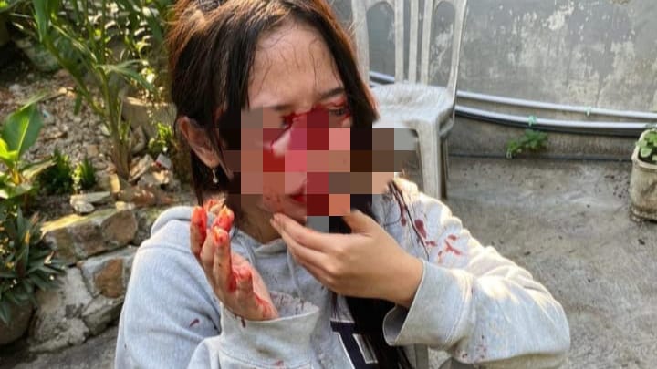 penumpang yang jadi korban penganiayaan driver ojol