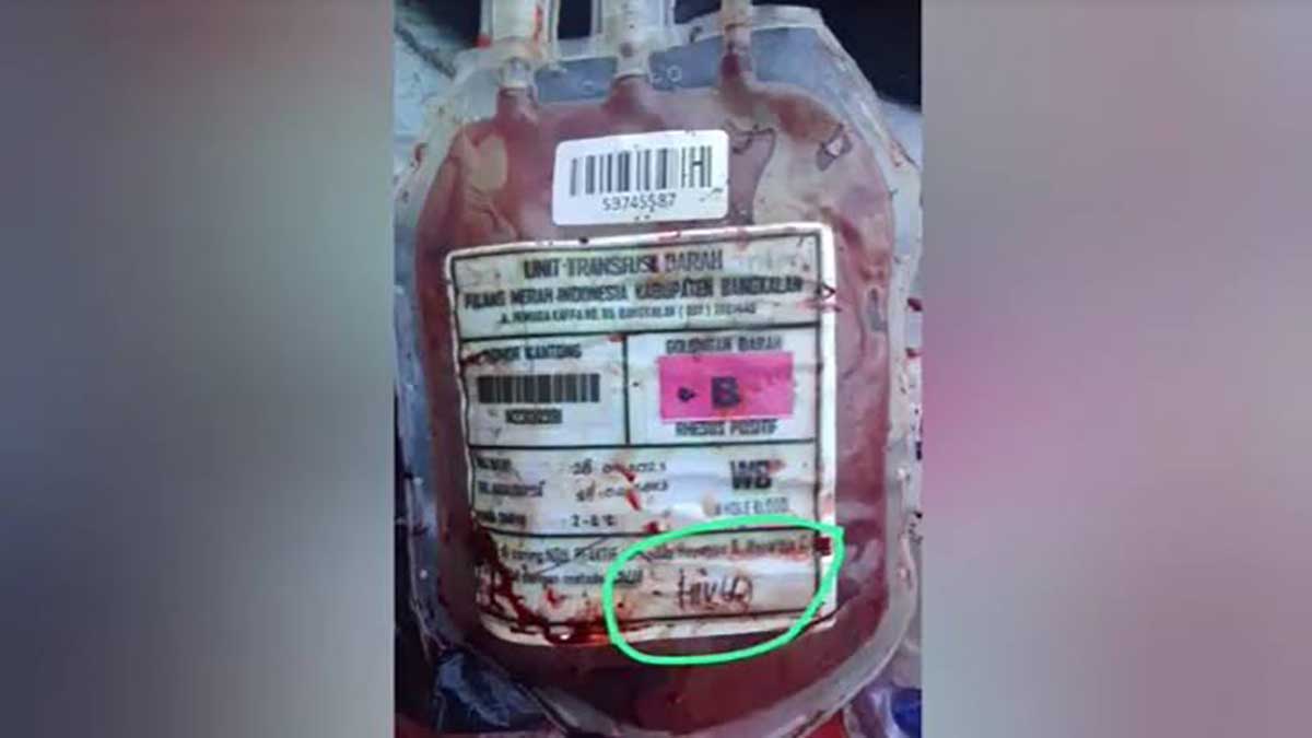 Temuan kantong darah HIV di Bangkalan. (ist) - Kemenkes Buka Suara Temuan Puluhan Kantong Darah HIV di TPS Bangkalan