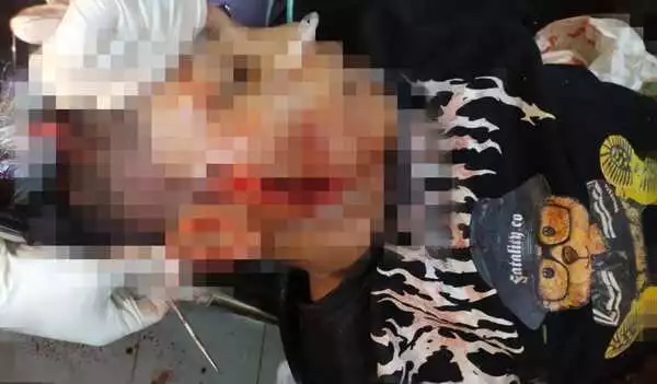korban saat ditangani pihak rumah sakit setempat. (udi) - Pemuda Asal Pemekasan Tewas Ditebas OTK bersama Orangtuanya