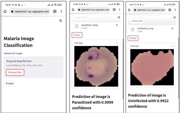 Citra foto pada penyakit malaria dan hasil deteksi parasit malaria melalui Artificial Intelligence. (ist) - Dosen Ma Chung Mampu Deteksi Malaria dan Diabetes Retinopati dengan Artificial Intelligence
