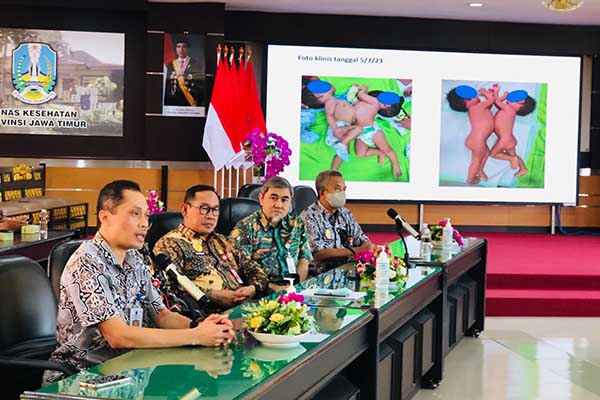 Preskon operasi pemisahan bayi kembar siam di RSSA Malang. (wul) - RSSA Bakal Operasi Pemisahan Bayi Kembar Siam Pertama