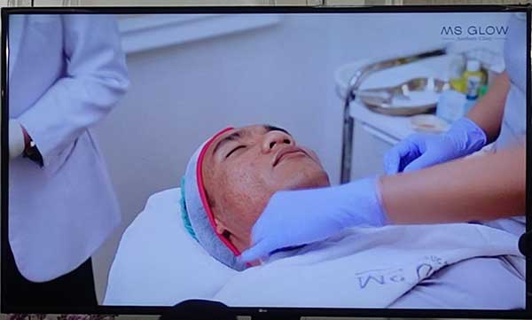 Salah satu proses treatment paket komplit Exosome Signal Cell Injection. (rhd) - MS Glow Launching Treatment Exosome Signal Cell Injection