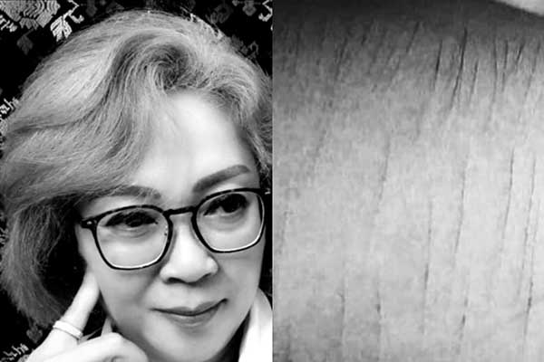 Fenomena Self Harm yang menjadi sorotan Psikolog Sayekti Pribadiningtyas SPsi MPd Psikolog. (ist) - Waspada Tren "Self Harm" pada Remaja, Segera Cek Tangan Anak Anda