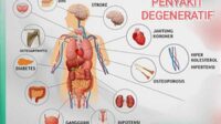 Ilustrasi Penyakit Degeneratif. (ist) - Pola Hidup Sehat Sejak Muda, Minimalisir Penyakit Degeneratif Saat Tua