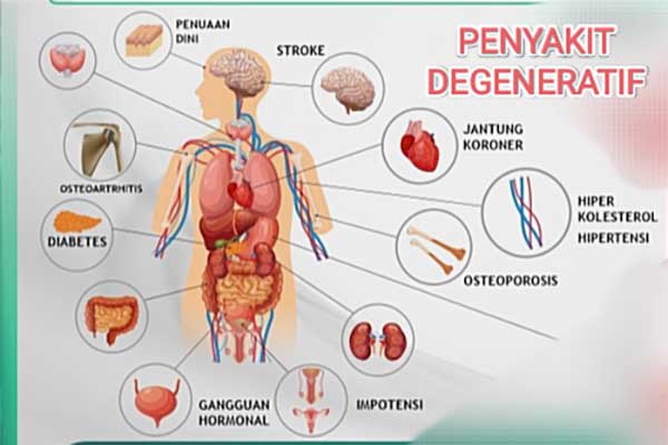 Ilustrasi Penyakit Degeneratif. (ist) - Pola Hidup Sehat Sejak Muda, Minimalisir Penyakit Degeneratif Saat Tua