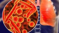 Wabah Pneumonia Mycoplasma, Apa Itu?
