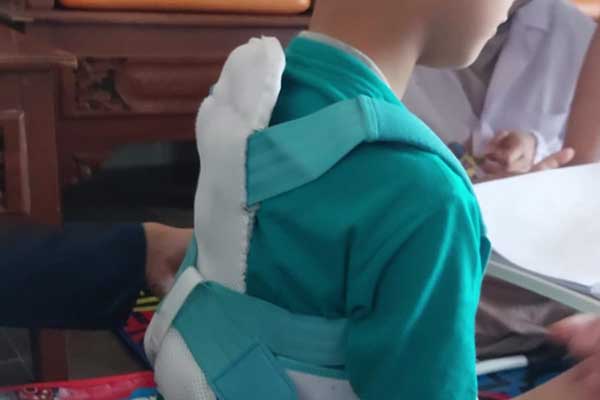 Prototipe PostureCare karya mahasiswa UB. (ist) - PostureCare, Terapi Kelainan Tulang Belakang Anak Karya Mahasiswa UB