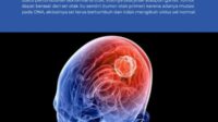 RSUD Soesodoro Djatikoesoemo Ajak Warga Kenali Sejak Dini Gejala Tumor Otak