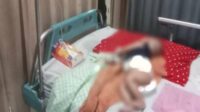 Balita berusia 1 tahun di Jember yang mengidap penyakit hernia. (ist) - Balita Pengidap Hernia di Jember Dapat Bantuan Anggota DPRD, Segera Jalani Operasi
