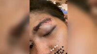 'No Viral No Justice' Pengusaha Hiburan Surabaya Dilaporkan Kasus Penganiayaan Berat Calon Terapis Perempuan, Empat Bulan Tanpa Kejelasan