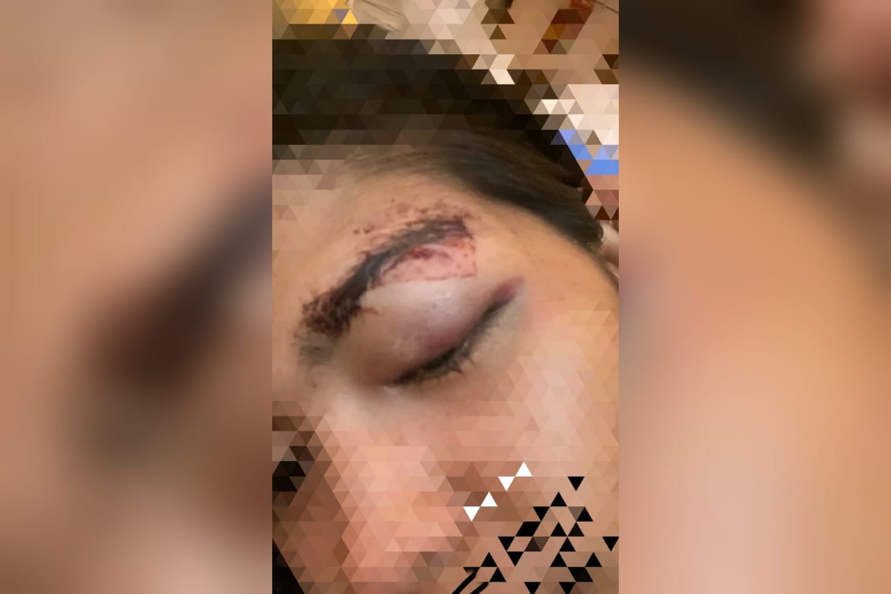 'No Viral No Justice' Pengusaha Hiburan Surabaya Dilaporkan Kasus Penganiayaan Berat Calon Terapis Perempuan, Empat Bulan Tanpa Kejelasan