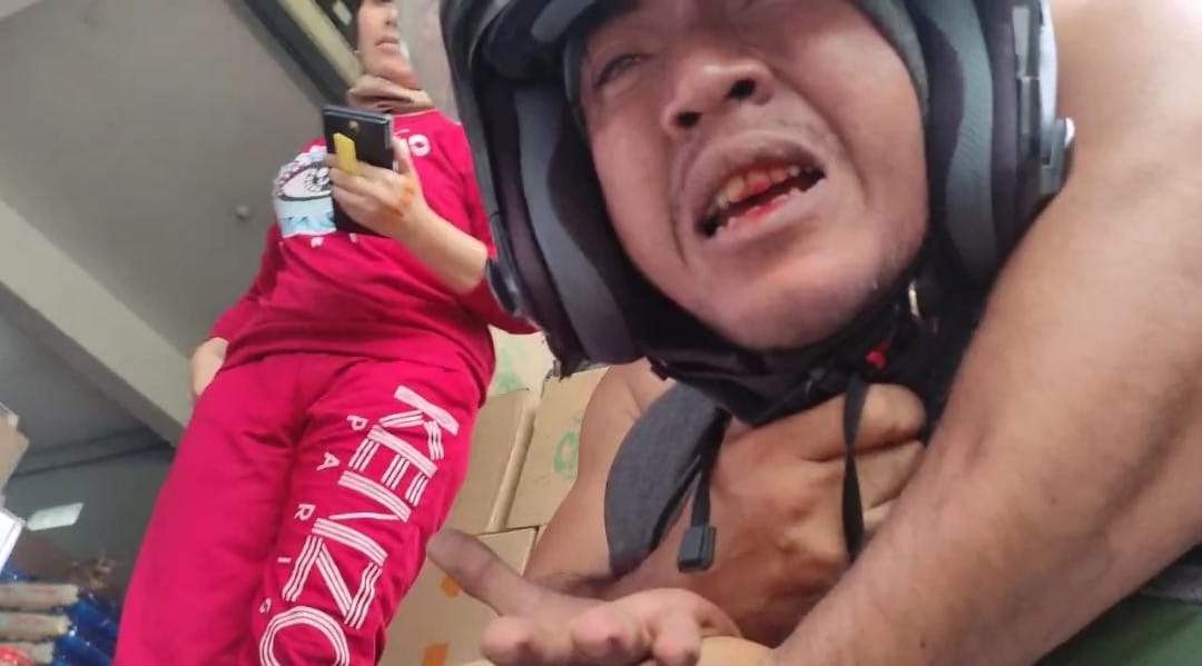 Kurir Ekspedisi JNT Pamekasan Jadi Korban Penganiayaan dan Pelaku Dilaporkan ke Polisi