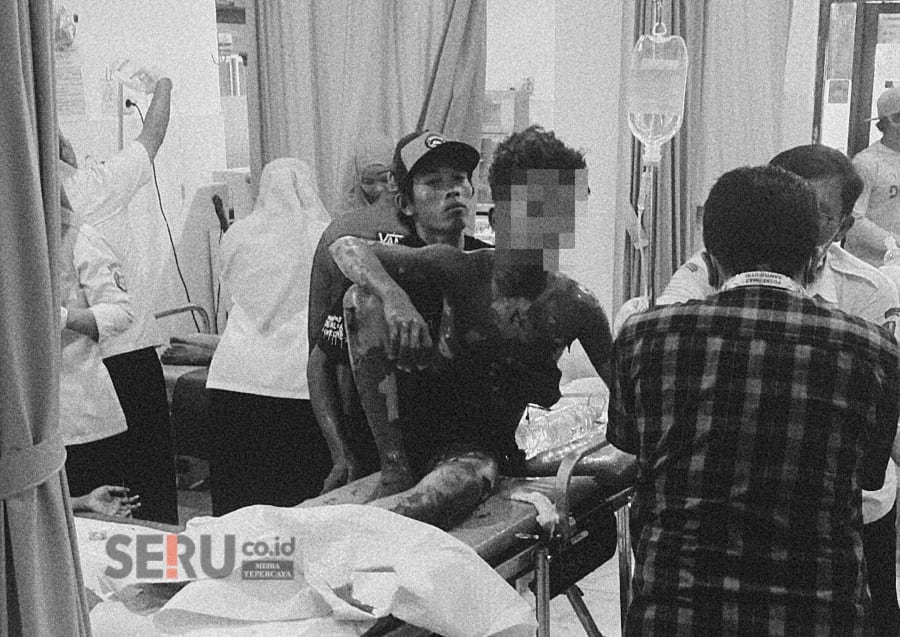 Ledakan Dahsyat Diduga Mercon Gemparkan Situbondo, Satu Tewas, Enam Luka-Luka dan Tujuh Rumah Rusak 1 Para korban dirawat di Puskesmas kemudian dirujuk ke RSUD Asembagus. (Seru.co.id/aza)